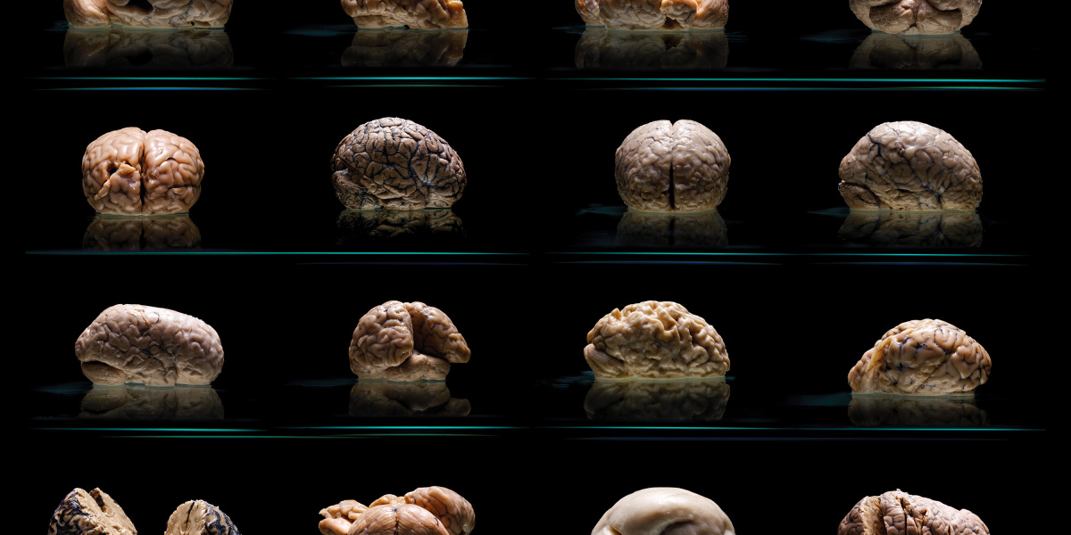 You are currently viewing The world’s largest collection of ugly brains